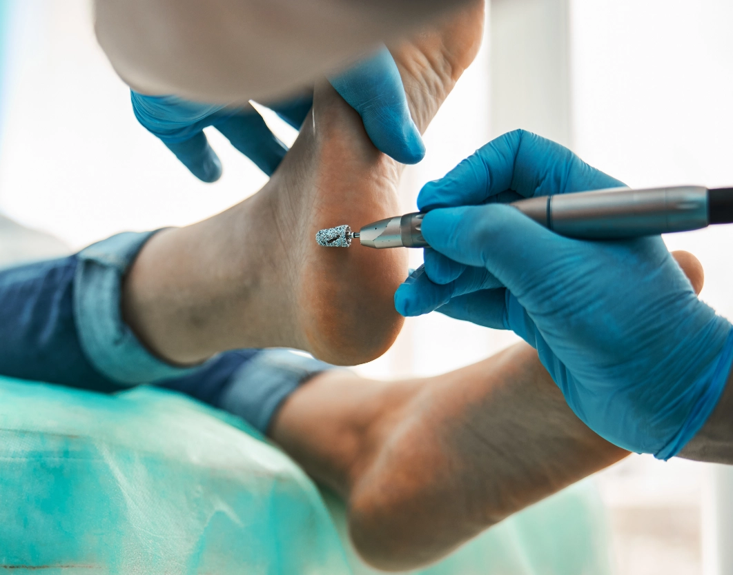 Patient receiving medical pedicure